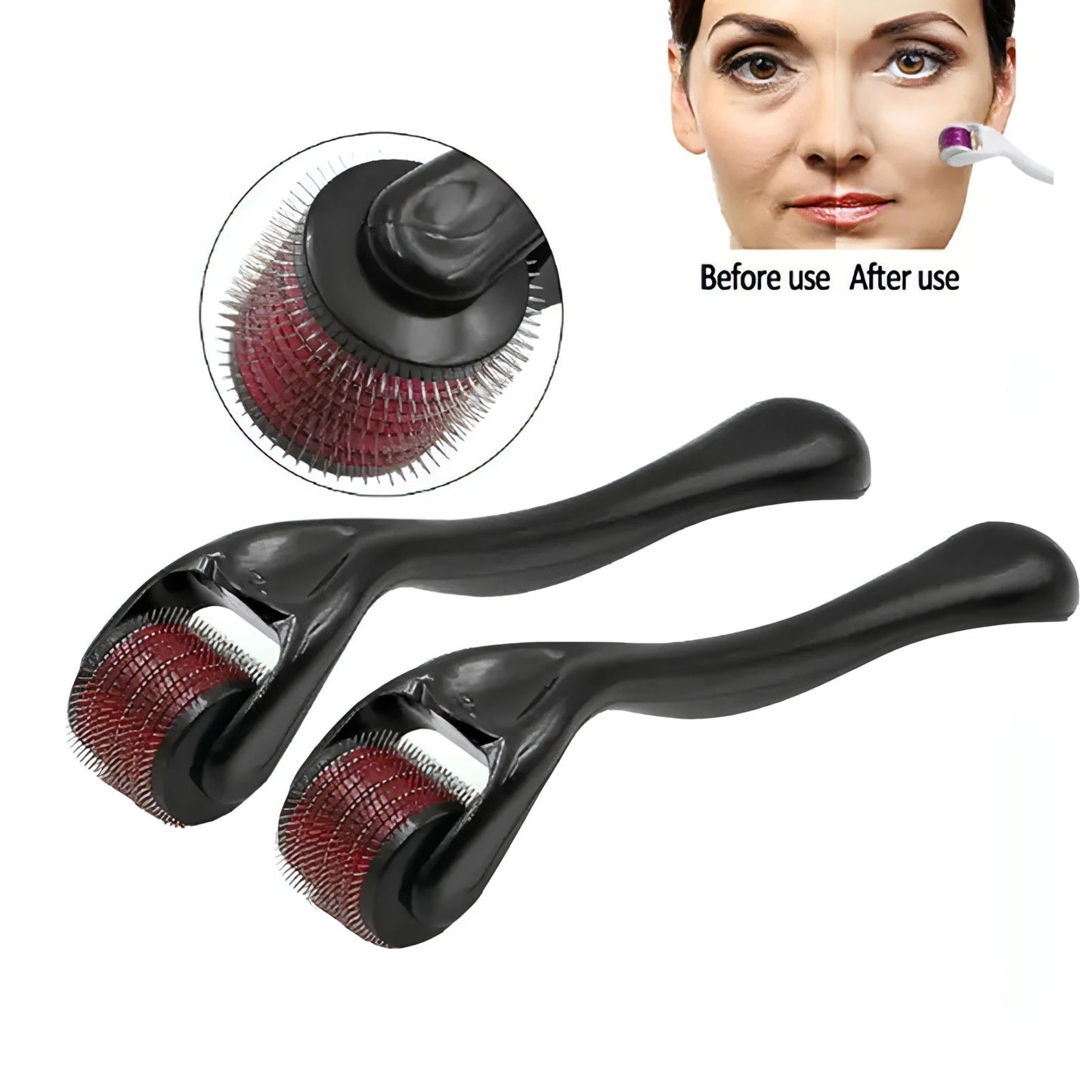 Titanium Microneedle Derma Roller - Allure SocietySkincare Accessories